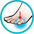 Toe Protector V2 (5 ks)