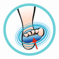 Gel Plantar Protector (1 pár)